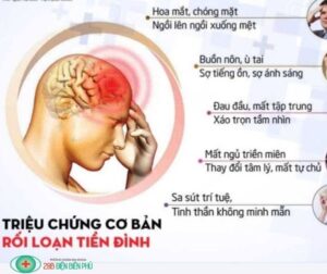 trieu chung co ban roi loan tien dinh