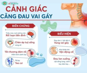 cang dau vai gay