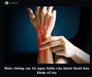 455677525 1298164611540466 3924425119295660643 n