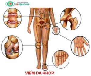 459365033 1319348242755436 8728861340068774012 n