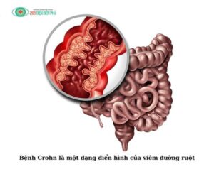 459457638 1318566449500282 4731889951508633865 n