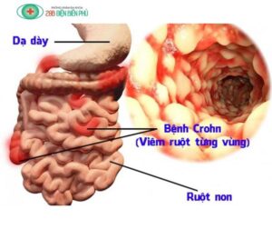 459605652 1319350566088537 5036850304981529296 n