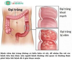 459883780 1320046412685619 6335766475440859035 n