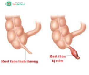 460026743 1321760115847582 8843896660829523904 n