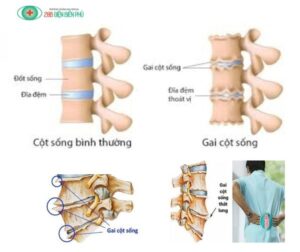 460577603 1323388882351372 7883186321899753722 n