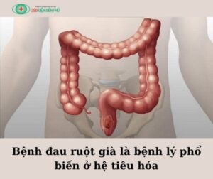 461254148 1329390041751256 954871912722312632 n