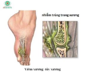 462692643 1341993060490954 8295438700287922320 n