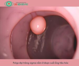 463738610 1348897656467161 5870719160946145789 n