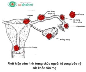 468445299 1380127906677469 5145833989424057783 n