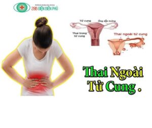 468542631 1380126520010941 7319512632926501700 n