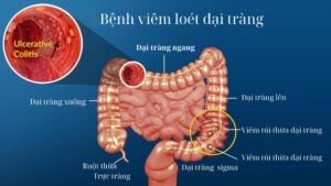 492271927 1506952267328365 9064693954338310770 n