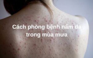 499408033 1530058965017695 1132194906366000981 n